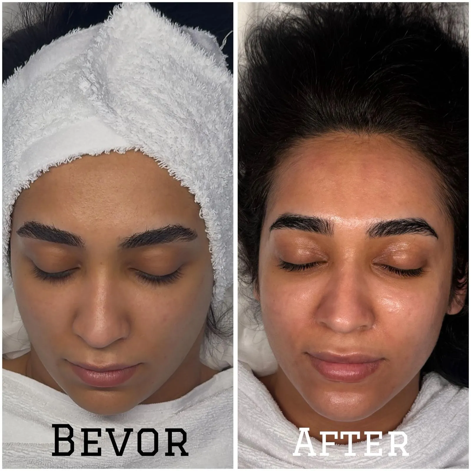 Gesichtsbehandlung Hamburg Preise 2026 : Die große Kosten-Tabelle Wer auf der Suche nach professioneller Hautpflege in der Hansestadt ist, wird schnell feststellen, dass die Gesichtsbehandlung Hamburg Preise stark variieren können. Eine transparente Übersicht ist daher entscheidend, um das passende Angebot für die individuellen Hautbedürfnisse zu finden. Die Kosten hängen oft von der Art der Anwendung, den verwendeten Produkten und der Dauer der Sitzung ab. Im Folgenden werfen wir einen detaillierten Blick auf die verschiedenen Preiskategorien und Behandlungsmöglichkeiten, die der Markt aktuell bietet, basierend auf realen Daten und Angeboten.