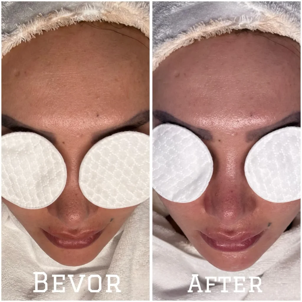 Wer heute nach effektiven Anti-Aging-Methoden sucht, steht oft vor der Wahl: invasiver Eingriff oder wirkungslose Creme? Dazwischen hat sich jedoch eine Technologie etabliert, die als Geheimtipp für straffe Haut ohne Skalpell gilt. Wer im Internet nach Galvanic Infusion Erfahrungen recherchiert, stößt auf zahlreiche Berichte über verjüngte Gesichtszüge und einen strahlenden Teint. Doch was steckt wirklich hinter der Behandlung mit galvanischem Feinstrom, und hält sie, was sie verspricht? Wir haben die Fakten analysiert und Berichte verglichen, um Ihnen ein klares Bild zu verschaffen.