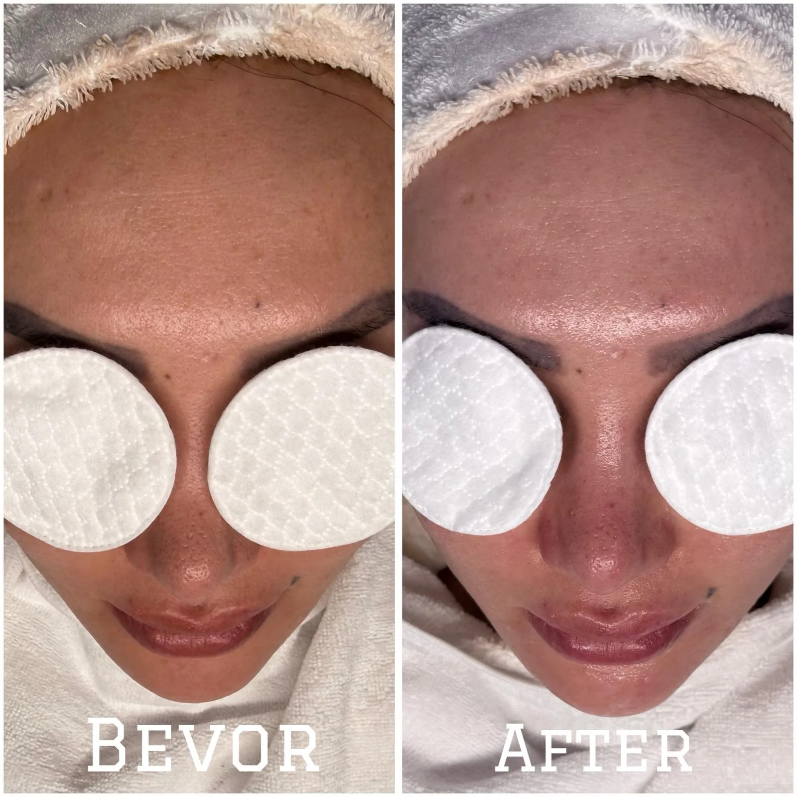 Wer heute nach effektiven Anti-Aging-Methoden sucht, steht oft vor der Wahl: invasiver Eingriff oder wirkungslose Creme? Dazwischen hat sich jedoch eine Technologie etabliert, die als Geheimtipp für straffe Haut ohne Skalpell gilt. Wer im Internet nach Galvanic Infusion Erfahrungen recherchiert, stößt auf zahlreiche Berichte über verjüngte Gesichtszüge und einen strahlenden Teint. Doch was steckt wirklich hinter der Behandlung mit galvanischem Feinstrom, und hält sie, was sie verspricht? Wir haben die Fakten analysiert und Berichte verglichen, um Ihnen ein klares Bild zu verschaffen.